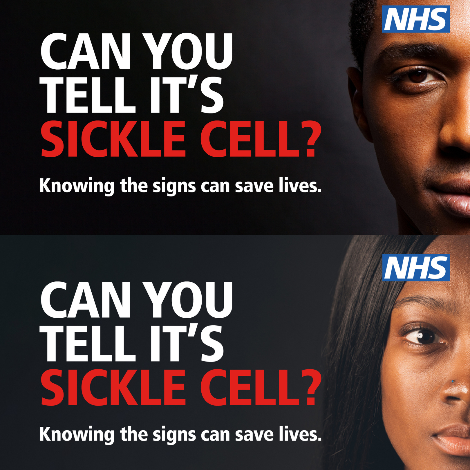 Can you tell it’s sickle cell? Know the signs to save lives | GP Care Group